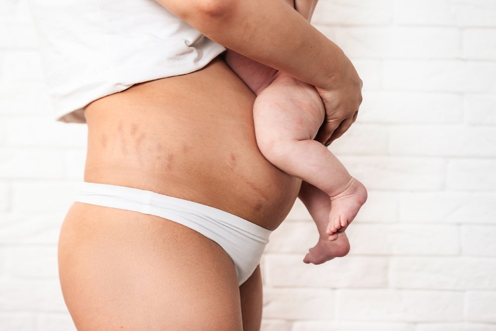 Postpartum mom holding newborn